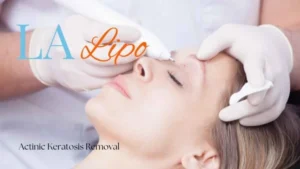 Woman receiving Actinic Keratosis Removal Treatment ENGLAND