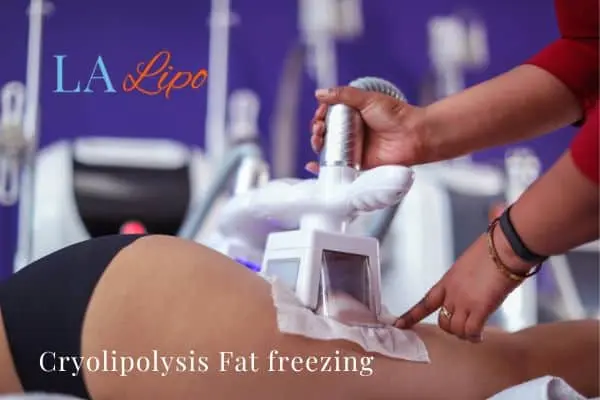 women getting fat freezing ENGLAND
