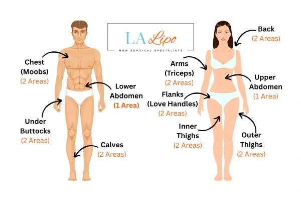 LA LIPO Cryolipolysis Areas ENGLAND
