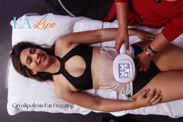 woman getting cryolipolysis ENGLAND