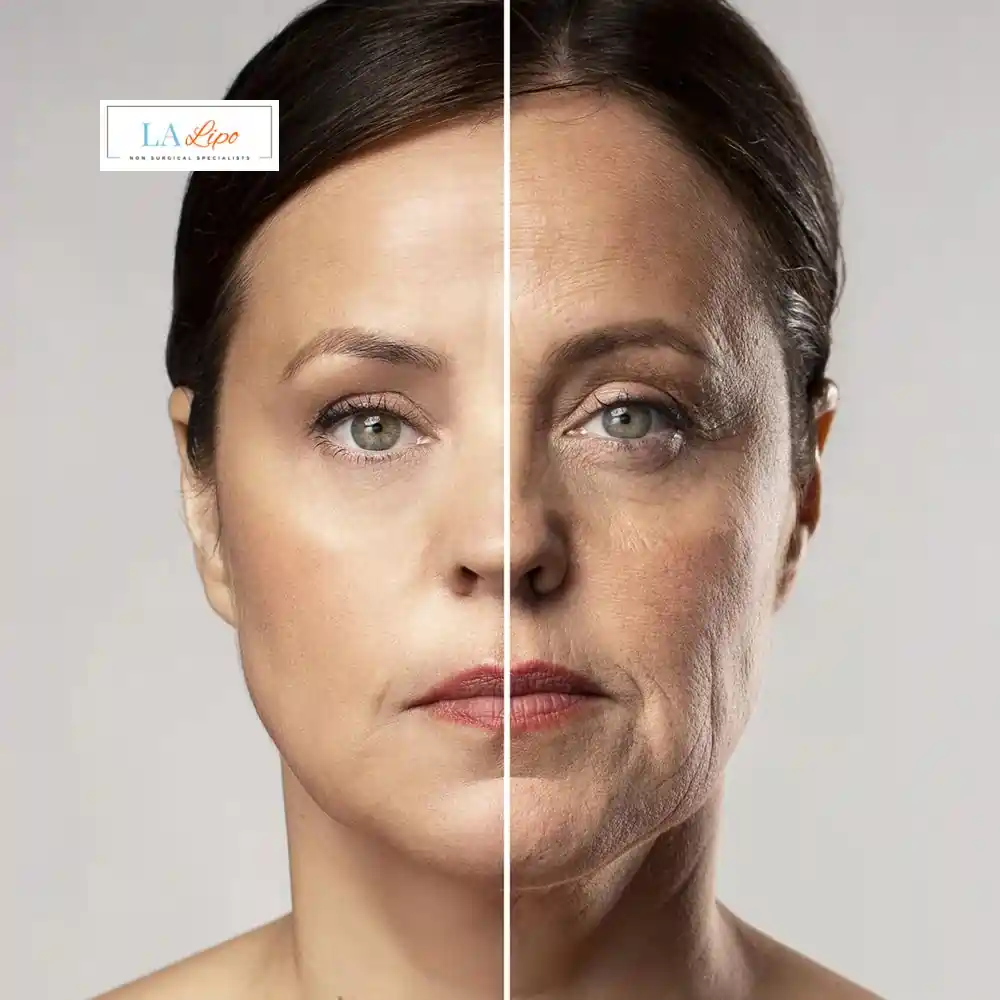 How Can You Tell If Non-Surgical Skin Tightening Is Right for You ENGLAND?