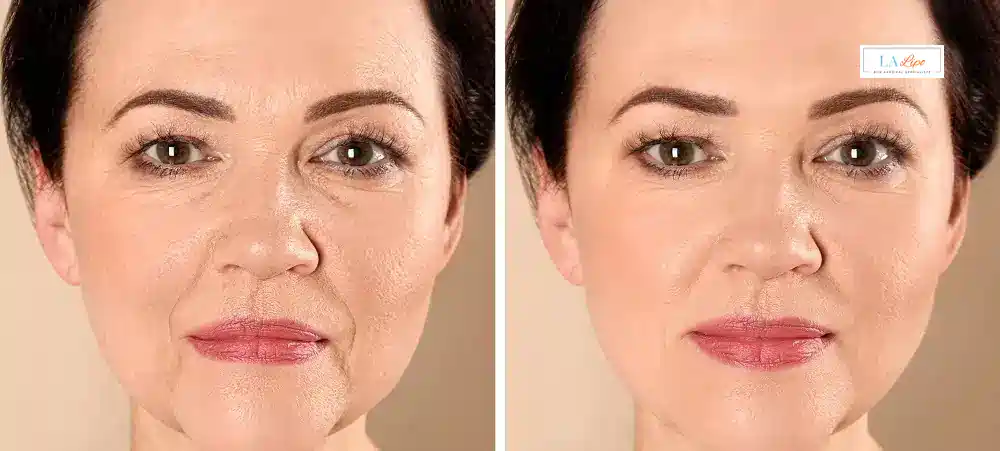 How Long Does It Take to See Results and How Long Do They Last ENGLAND?