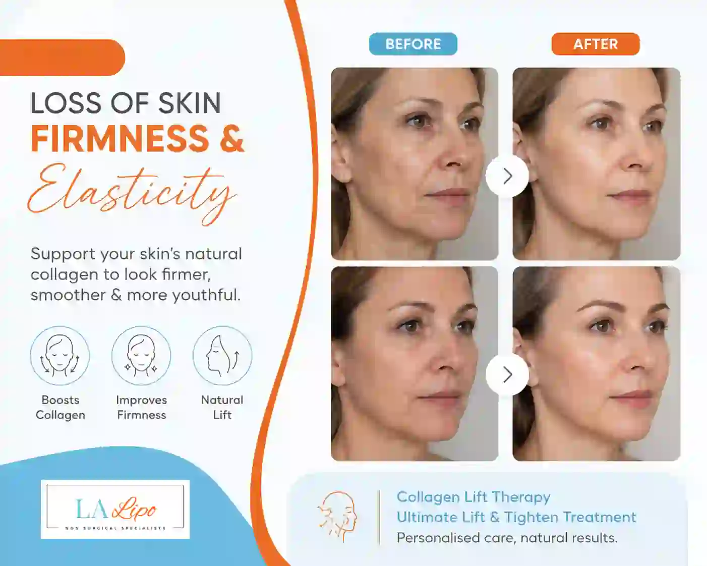 Sign #7: Loss of Skin Firmness and Elasticity ENGLAND